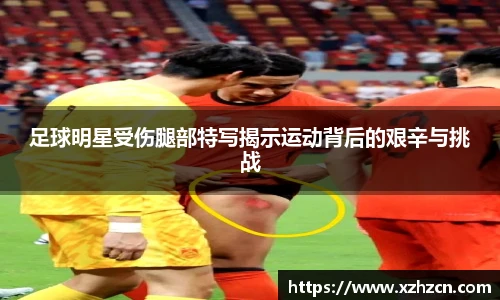 足球明星受伤腿部特写揭示运动背后的艰辛与挑战
